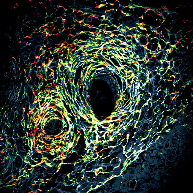 Startseite | Max-Planck-Institut Für Biochemie